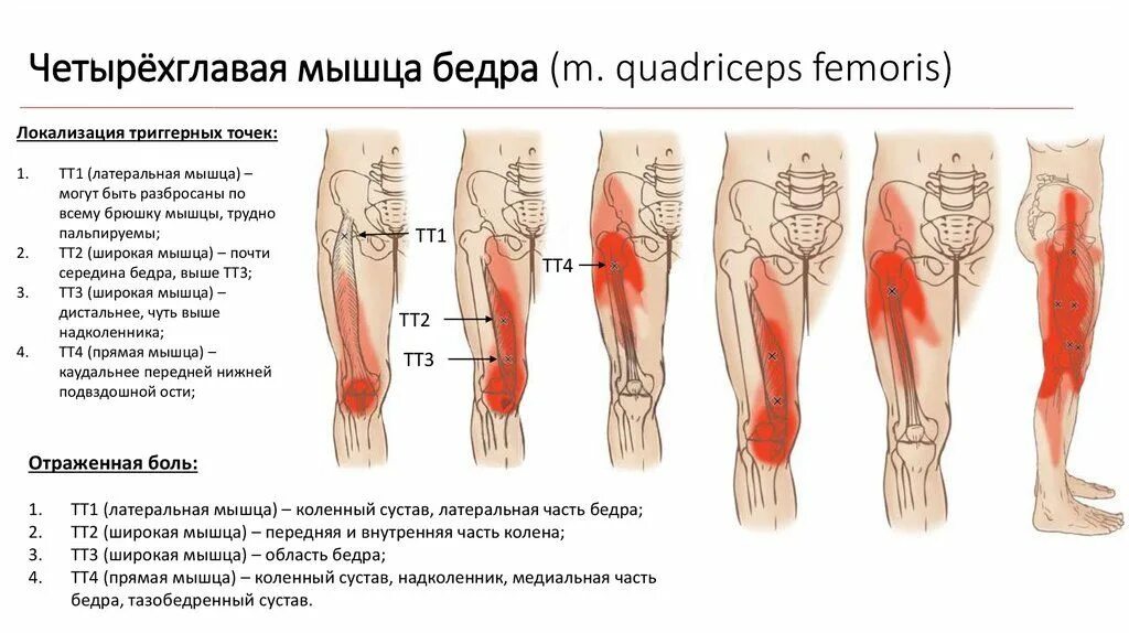 Болит нога ноет тянет. Прямая мышца бедра триггерные точки. Мышцы передней поверхности бедра. Мышцы наружной стороны бедра. Триггерные точки мышц ног.
