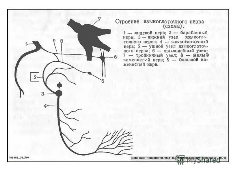 Поражение языкоглоточного нерва