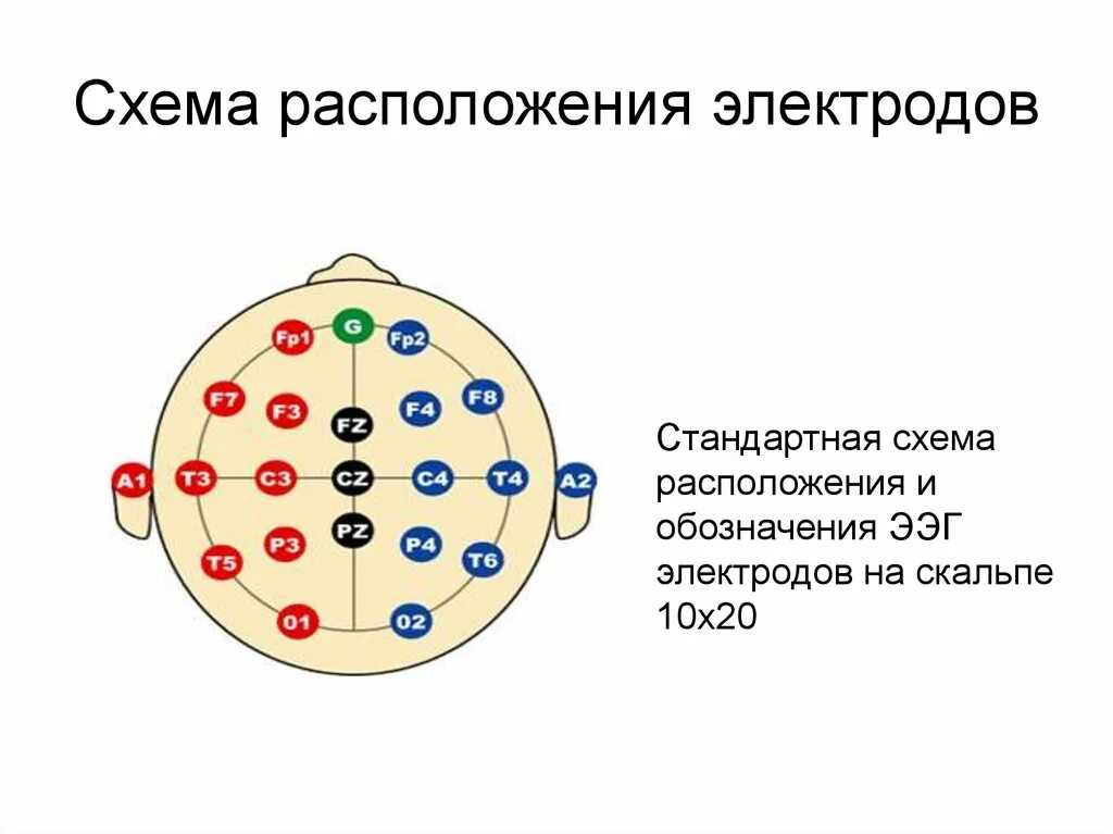 Ээг 10 10. Схема расположения электродов при ЭЭГ 10-20. ЭЭГ накладывание электродов. Международная схема электродов ЭЭГ 10-20. ЭЭГ схема наложения.