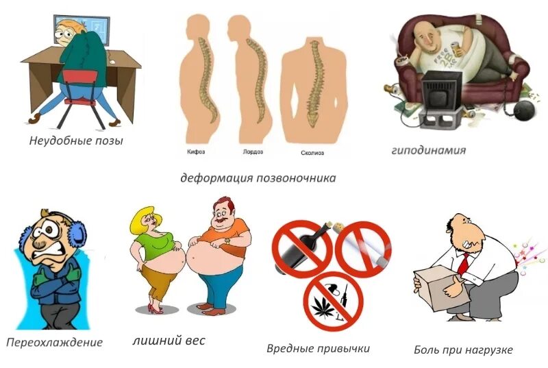 Гиподинамия это простыми. Гиподинамия. Гиподинамия симптомы. Гиподинамия симптомы и последствия. Гиподинамия рисунок.