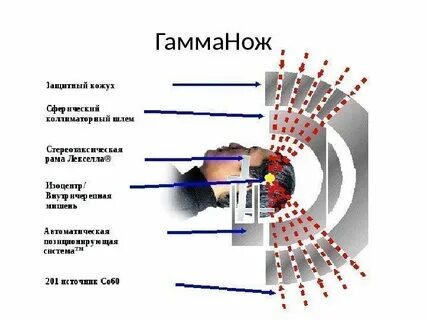 Гамма нож по омс