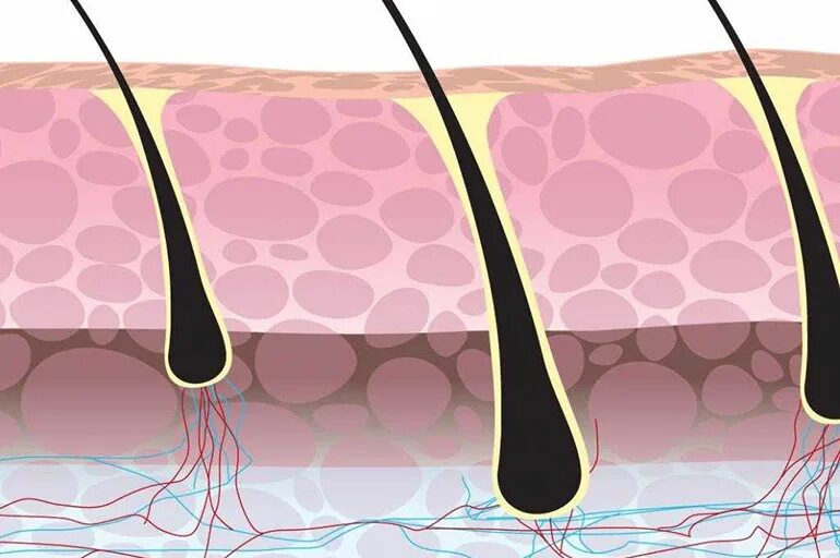 Пробуждение волосяных луковиц. Волосяная луковица. Здоровая волосяная луковица. Тонкие волосяные луковицы. Волос с волосяной луковицей.