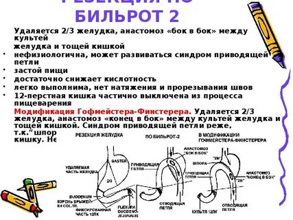 1 3 желудка