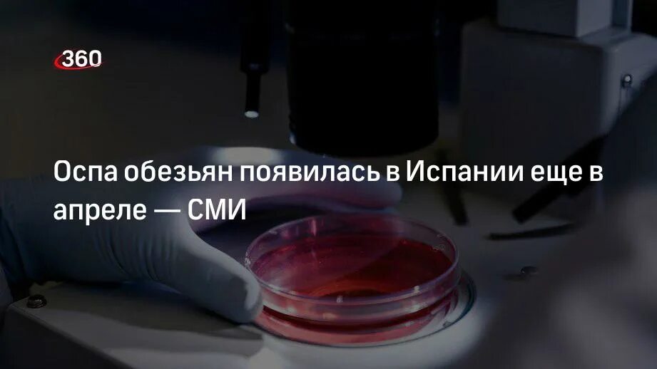 Оспа обезьян начинает распространяться по всему миру. Оспа обезьян начинает распространяться по всему миру