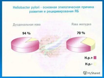 Признаки язвы желудка лечение