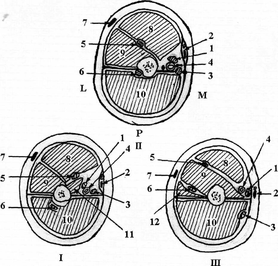 Топографические срезы. Поперечный срез плеча верхняя треть. Поперечный распил плеча 3 уровня схема. Поперечный распил бедра в верхней трети. Поперечные срезы плеча топографическая анатомия.