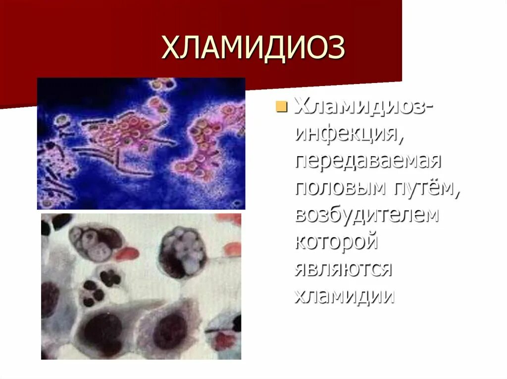 Хламидия chlamydia. Урогенитальный хламидиоз Дерматовенерология.