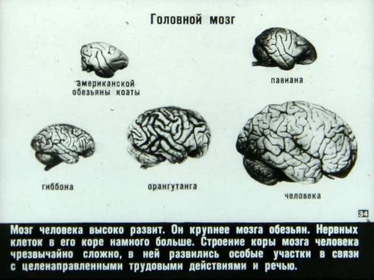 Мозг гориллы и человека. Мозг человека и мозг обезьяны. Головной мозг человека и обезьяна. Объем головного мозга наибольший у. Мозг обезьяны строение.