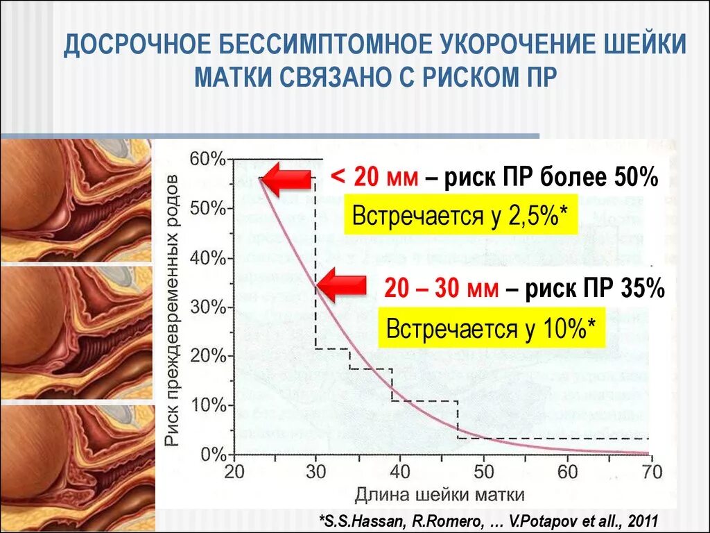 Почему укорачивается матка. Норма длины шейки матки при беременности 20 недель. Шейка матки на 32 неделе беременности норма. Норма длины шейки матки при беременности 30 недель. Шейка матки 35 мм при беременности.