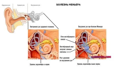 Почему шум в одном ухе