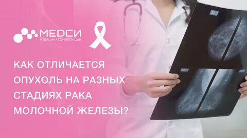 Рак груди1 стадии как распознать у женщин