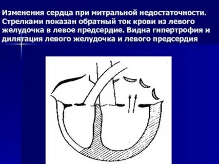 Ток сердца