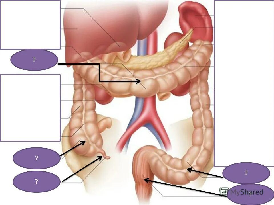 операция слепой кишки