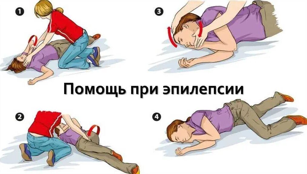 Повторяются приступы эпилепсии. Оказание помощи при эпилептическом приступе. первая помощь при эпилепсии. оказание первой помощи при эпилепсии припадке.