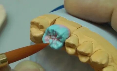 Дипломная работа зубной техник