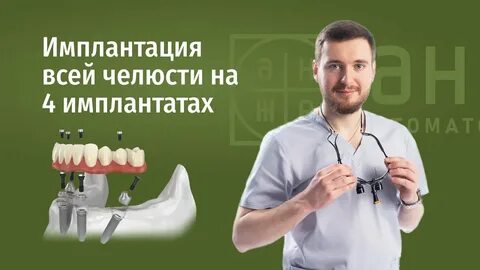 Импланты все на 4 отзывы форум