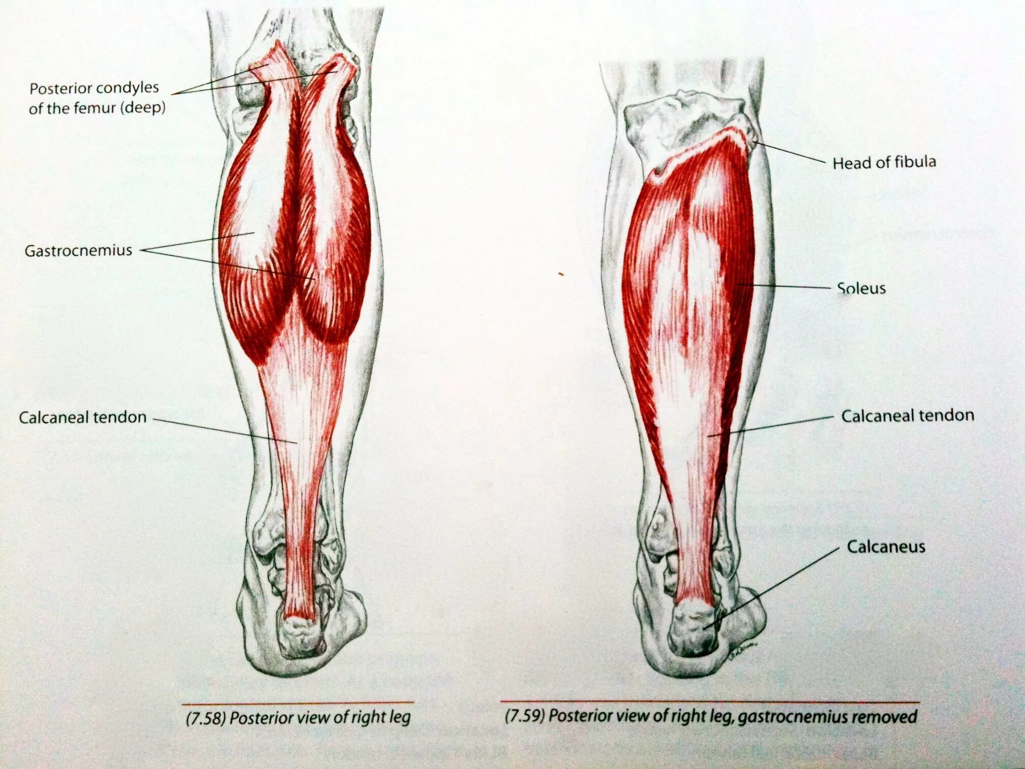 Икроножная мышца бедра анатомия. Камбаловидная мышца анатомия. Икроножная мышца голени анатомия. Soleus мышца голени. Место ниже бедра
