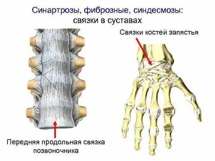 Фиброзные кости