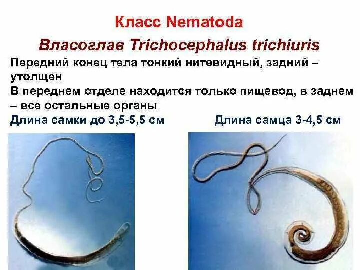 Власоглав /Trichocephalus Trichiurus/ паразит. Власоглав возбудитель трихоцефалеза. Власоглав человеческий яйца. Круглые черви паразиты власоглав.