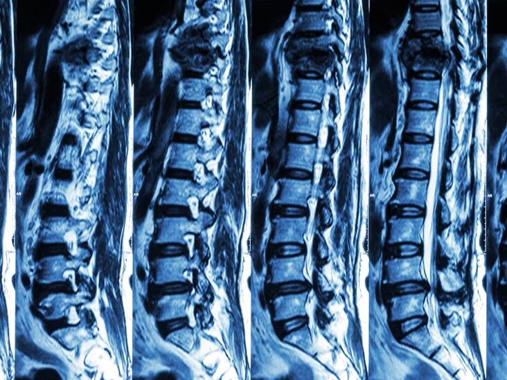 Как делают кт пояснично крестцового отдела. Мрт с-spine. мрт пояснично грудного отдела в спб. снимок мрт поясничного отдела. мрт поясничного отдела позвоночника.