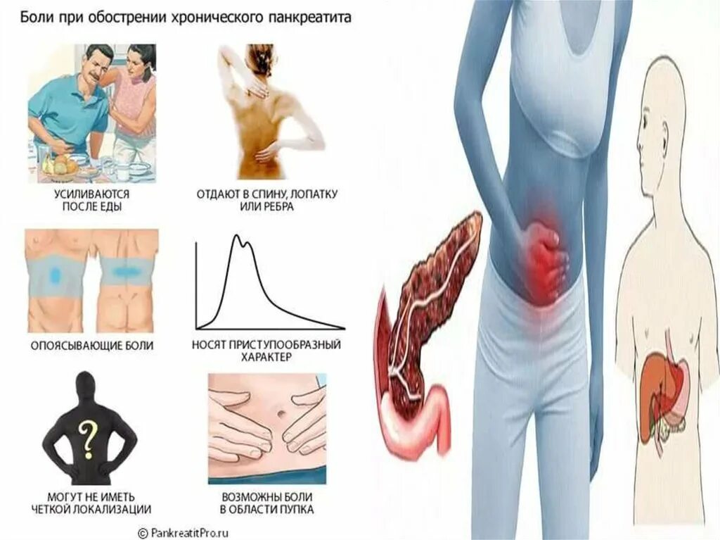 Панкреатит болит спина. Острый панкреатит симптомы локализация боли. Локализация боли при остром панкреатите. Локализация боли при хроническом панкреатите.
