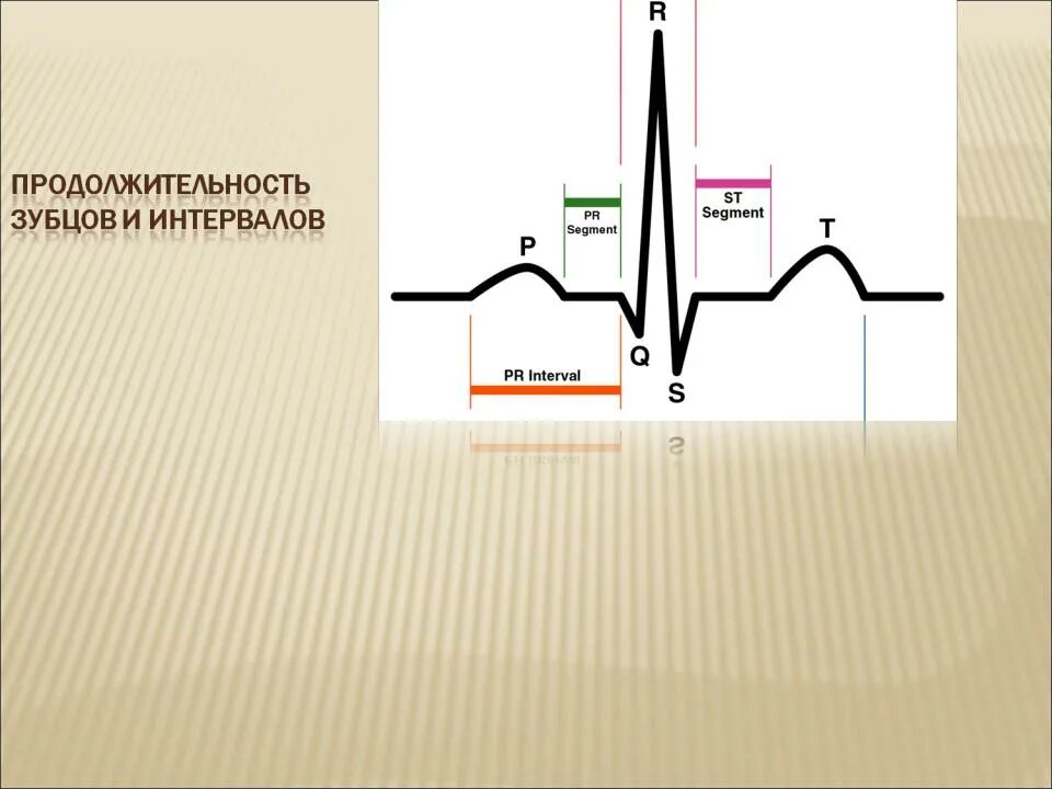 Увеличение интервала pq. Длительность комплекса QRS на ЭКГ. ЭКГ ширина комплекса QRS. Комплекс QRS на ЭКГ норма. Интервал QRS на ЭКГ.