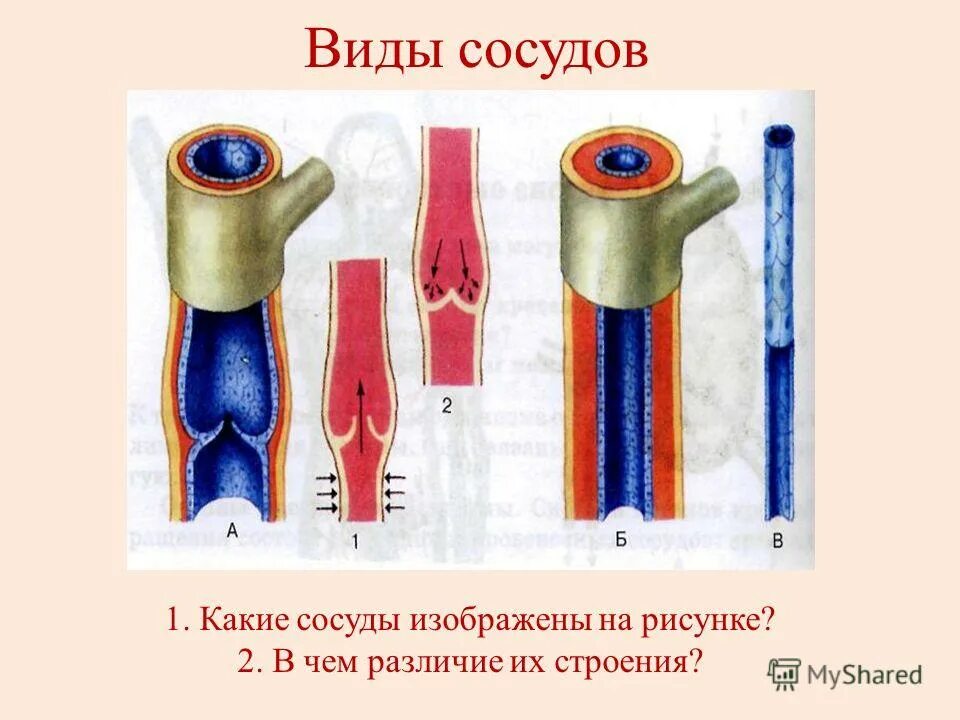 Чем характеризуются сосуды. Виды сосудов. Виды сосудов рисунок. Виды кровеносных сосудов.