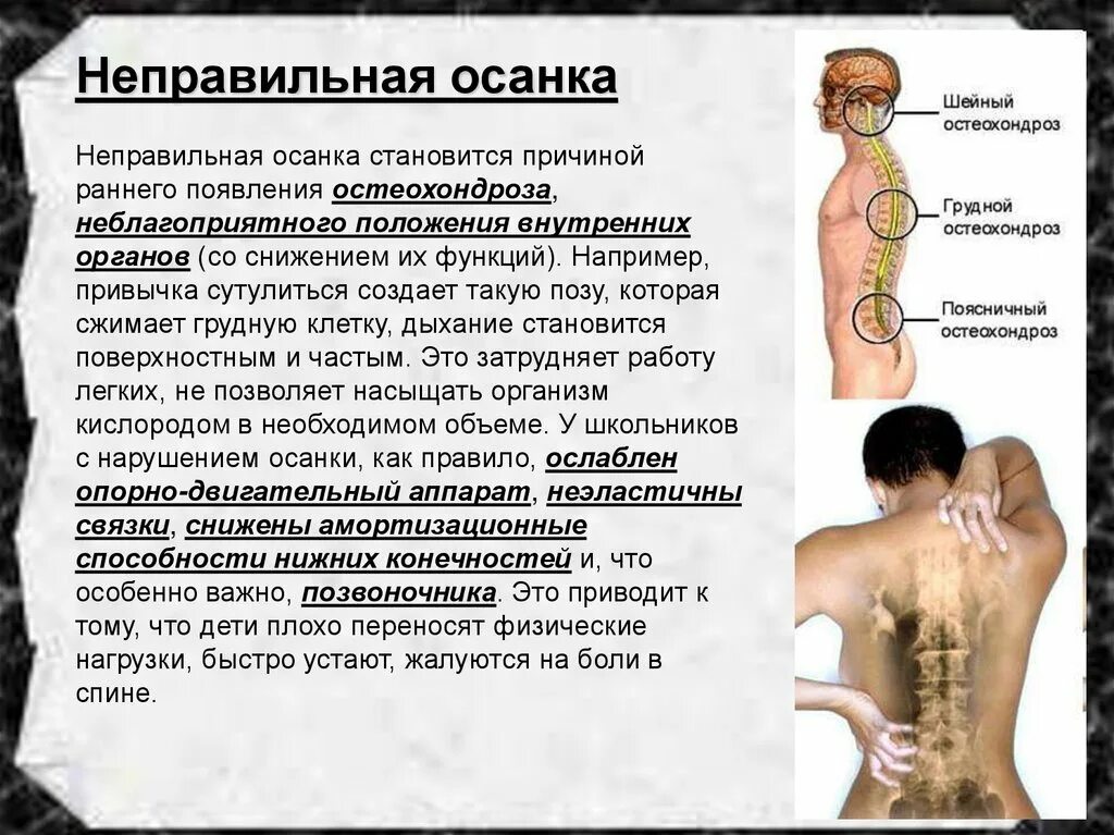 Неправильная посадка за партой. Причины нарушения осанки. Последствия нарушения осанки. Почему происходит неправильная. Профилактика осанки.