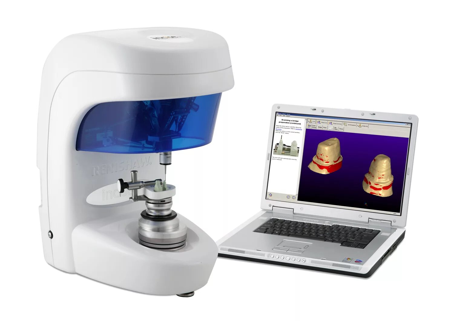 Cad cam системы. Cad cam технологии в стоматологии. кад кам системы в стоматологии. cad cam технологии в ортопедической стоматологии. 3d и cad/cam сканер стоматология.