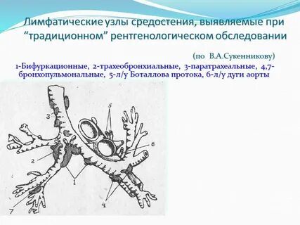 Лимфоузлы средостения