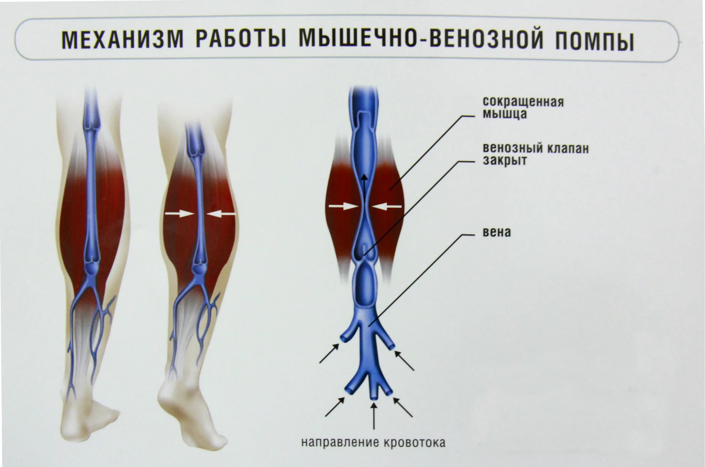 Тромбоз бпв