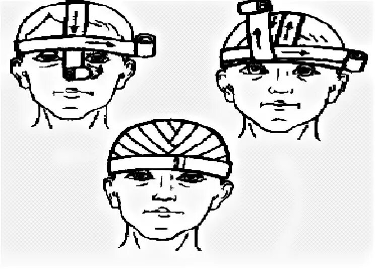 Повязка шапочка гиппократа техника наложения. Чепец и шапочка Гиппократа. Шапочка Гиппократа техника. Повязка чепец и шапочка Гиппократа. Шапочка Гиппократа повязка техника наложения.