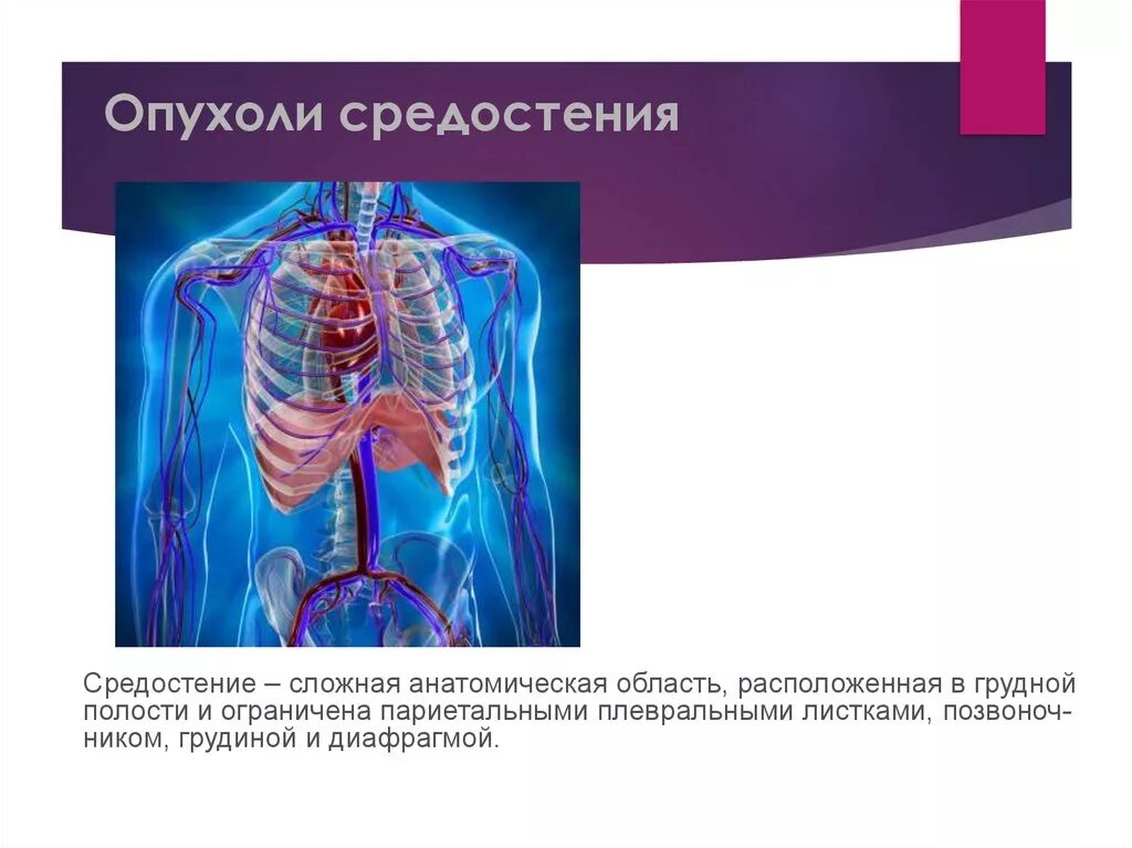 Лечение опухолей средостения. Злокачественная опухоль средостения рентген схема. опухоли средострастия. нейрогенные опухоли средостения. объемное образование средостения.