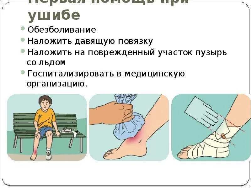 Кровотечение в коленный сустав. Оказание первой медицинской помощи при ранениях и травмах ушибах. Оказание первой помощи при уш. Первая аомощи при травмах. Первая помощь притрамах.