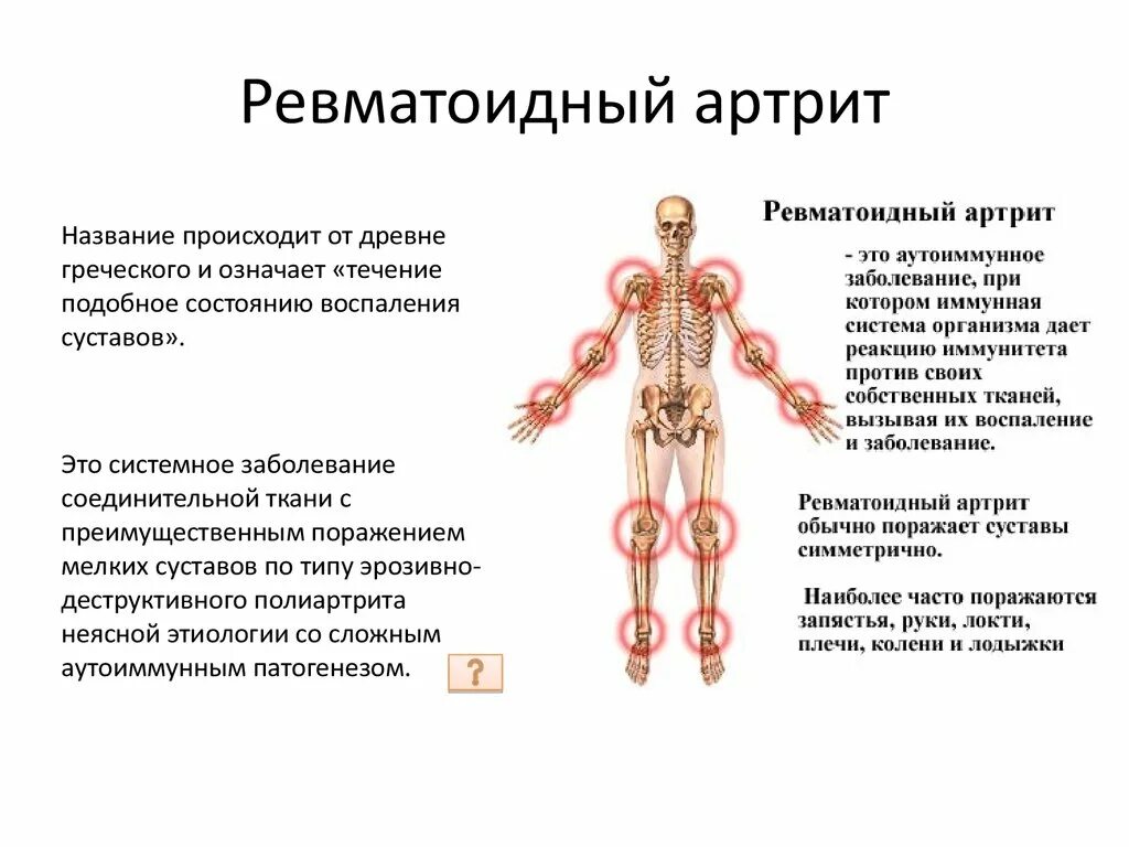 Ревматическое поражение суставов