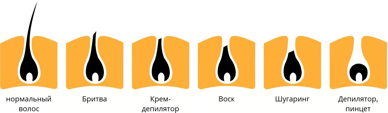 Виды эпиляции зоны. Лазерная эпиляция зоны эпиляции. Зоны депиляции в схемах. Виды эпиляции зоны. Зоны депиляции.