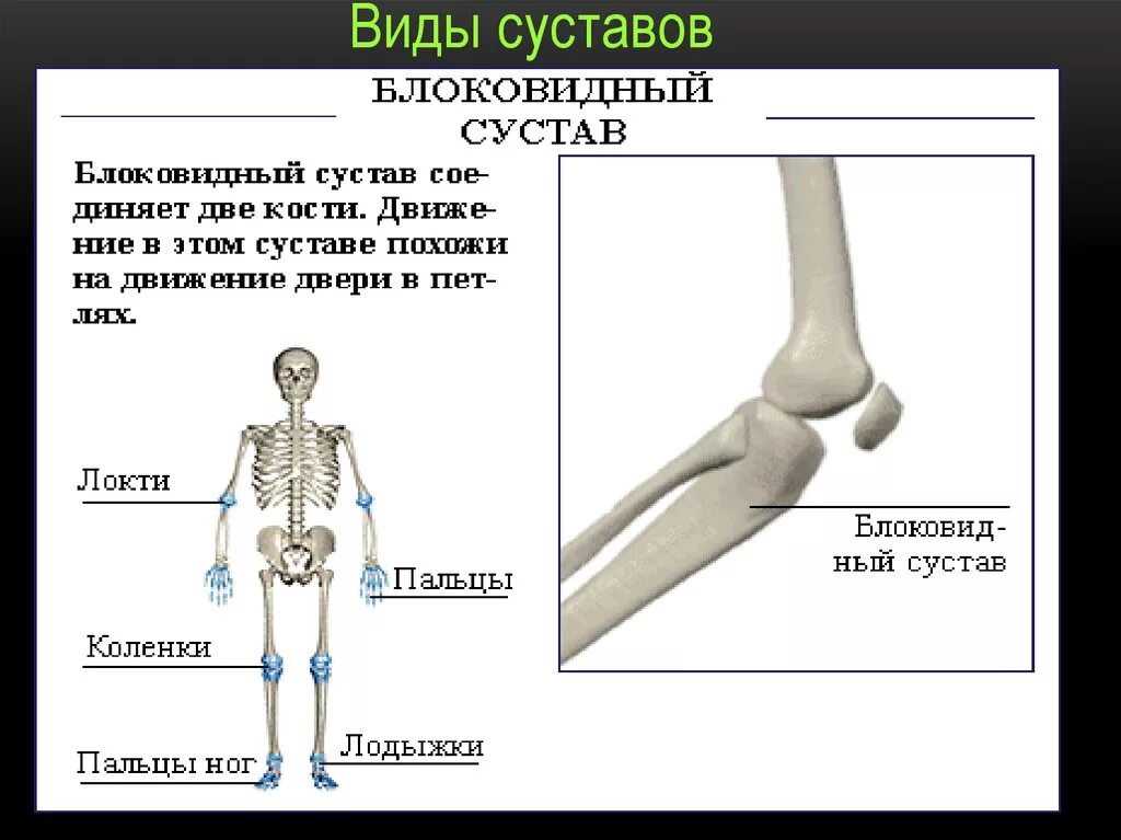 Названия суставов человека. Виды суставов. Блоковидный сустав. Винтовой сустав. Строение блоковидного сустава.