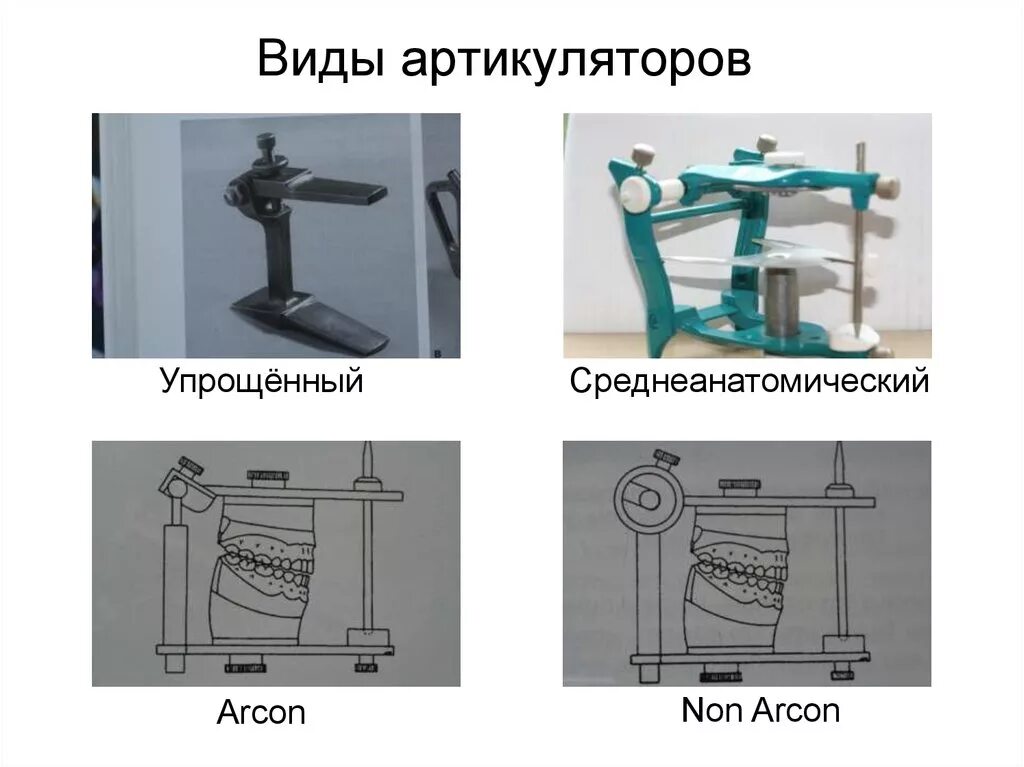Виды артикуляторов