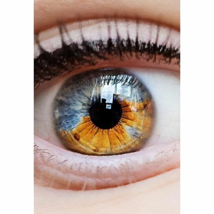 Как выглядит центральная гетерохромия глаз What Is the Rarest Eye Color HowStuffWorks