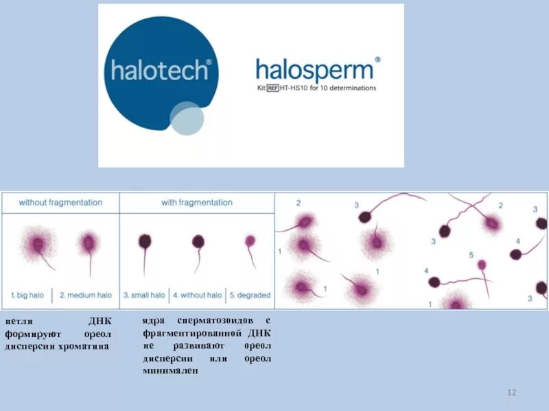 Днк методом tunel. Расшифровка фрагментации ДНК спермограммы. Фрагментация ДНК сперматозоидов (метод tunel). ДНК фрагментация сперматозоидов расшифровка. Фрагментация ДНК сперматозоидов показатели нормы.