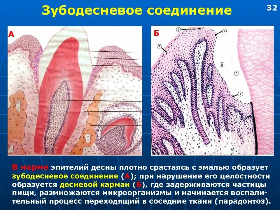 Зубодесневое соединение гистология. Зубодесневое прикрепление гистология. Периодонт гистология препарат. Зубодесневое соединение гистология препарат.