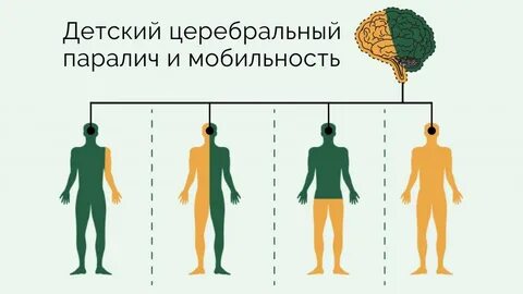 Дцп поражение