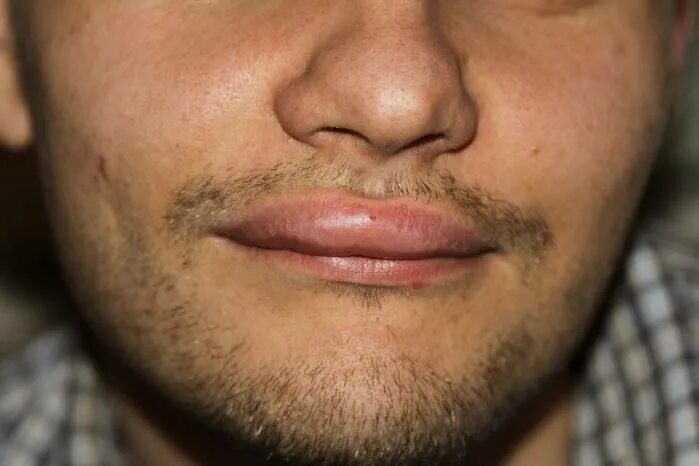 узкие мужские губы. нижняя губа человека. нижняя губа человека. нижняя губа человека. нижняя губа человека.