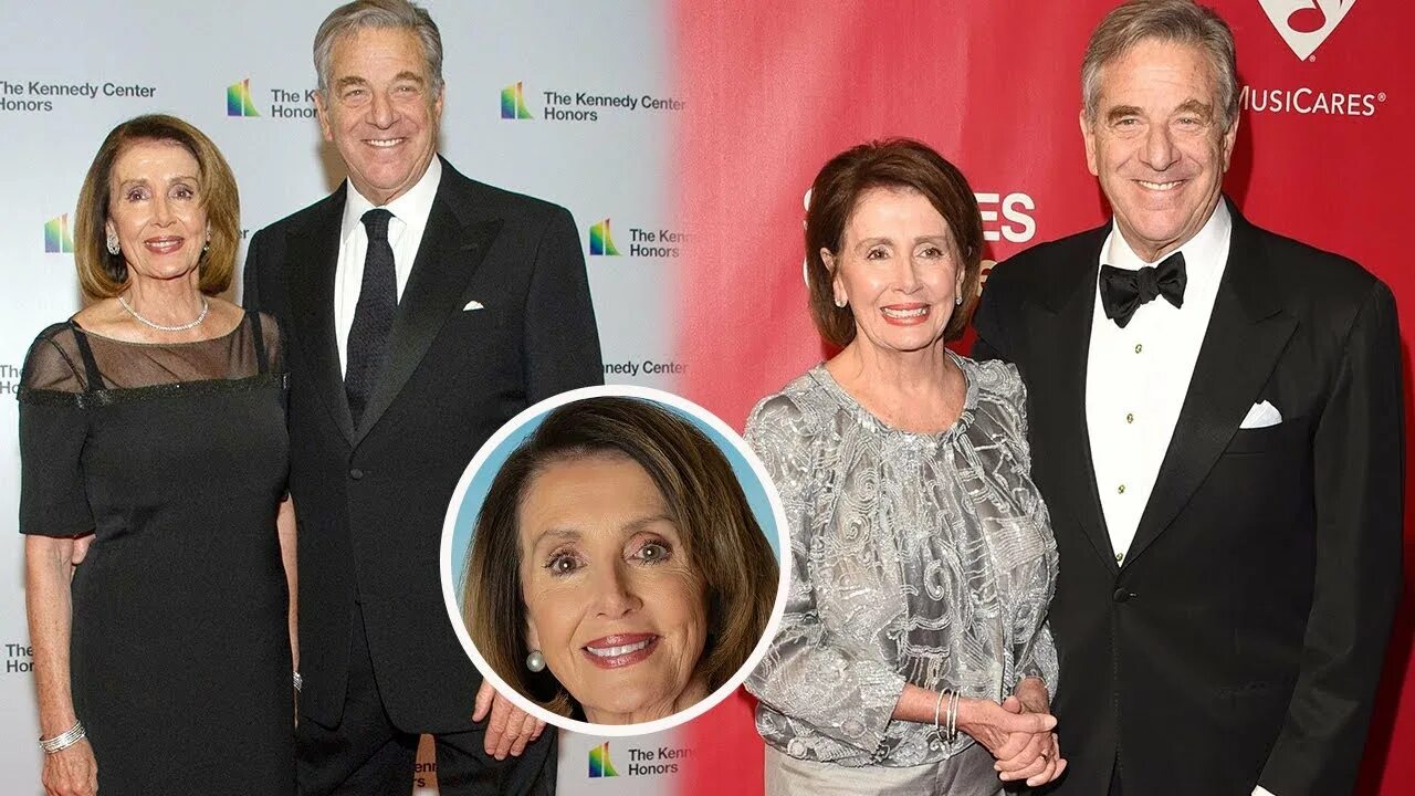 nancy pelosi facial fillers before and after - Latest Plastic Surgery Gossip And