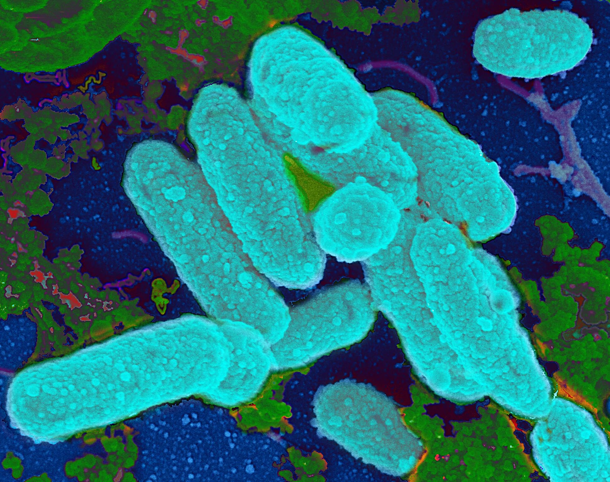 Бактерии Haemophilus influenzae. Бактерий палочка гемофильная палочка. Палочка Афанасьева-Пфейффера. Гемофильная палочка возбудитель. Бактерия синегнойная палочка