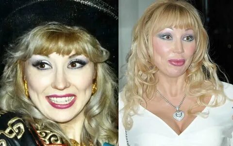 Покажи пластики