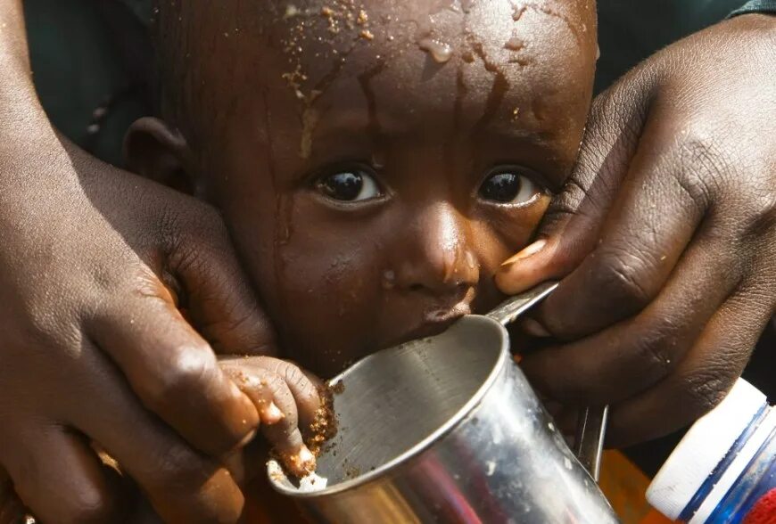 Голодающие дети африки третий мир. Голод проблема человечества. Голод проблема мировая. Голод проблема человечества. Продовольственная проблема.