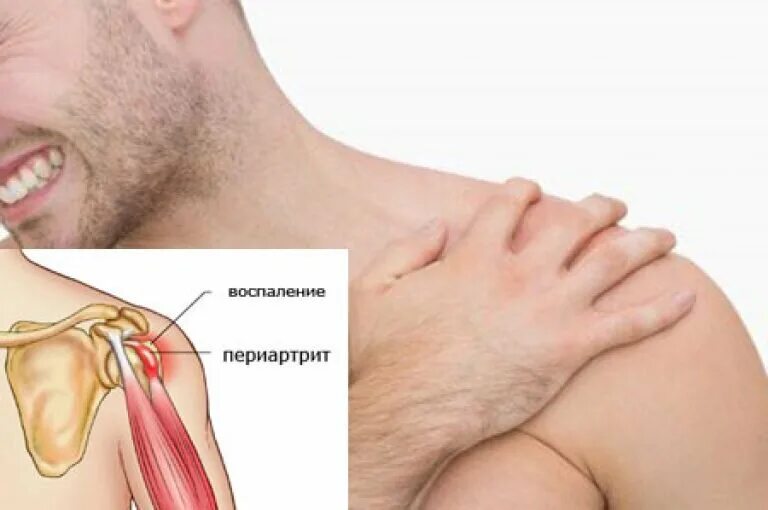 Может ли быть хруст