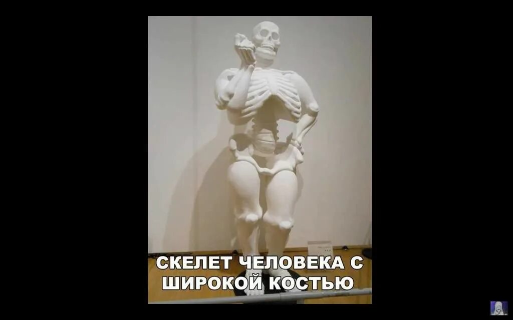 Широкая кость лица. Широкая кость. Скелет с широкой костью. Человек с широкой костью прикол. У меня кость широкая.