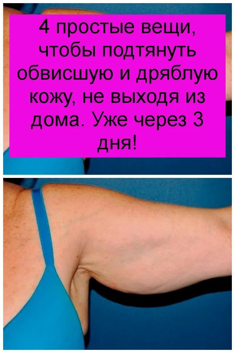 После похудения обвисла кожа как подтянуть. Подтянуть обвисшую кожу на руках. как подтянуть обвисшие руки. упражнения для обвисшей груди.